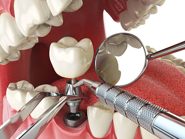Best Dental Abscess Treatment in North Eagle Butte, SD